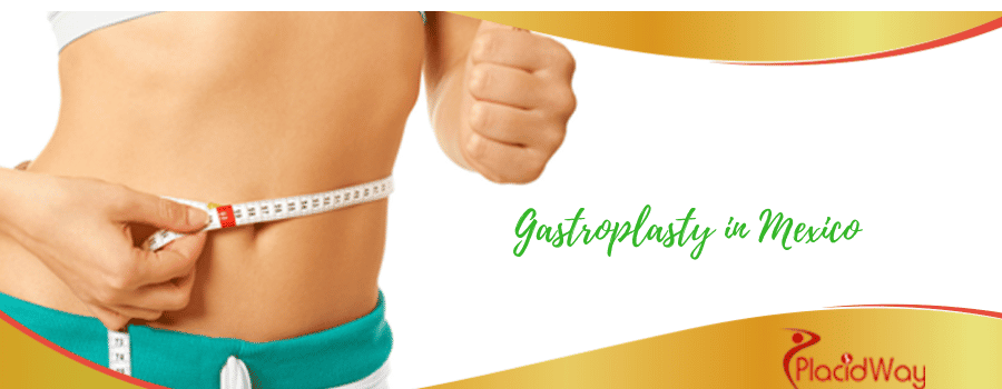 Gastroplasty in Mexico Gastroplasty in Mexico